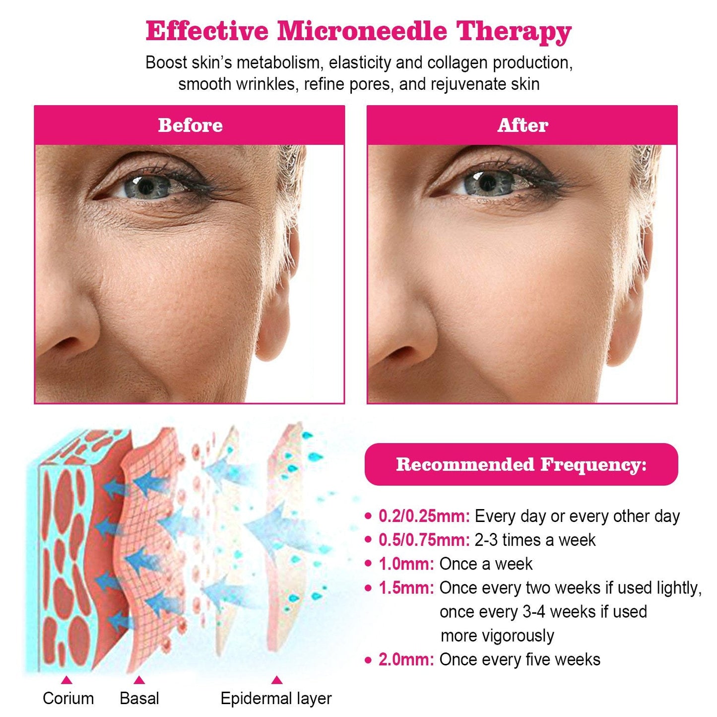 192Pcs Titanium Microneedles Facial Roller