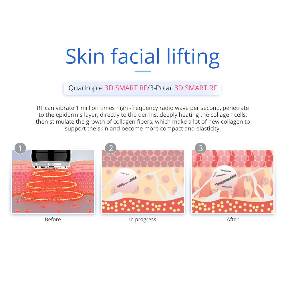 Shape Tactics 7-in-1 40K Ultrasonic Cavitation & RF Hot-Cold Therapy System